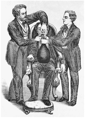 Nitrous Oxide, commonly known as laughing gas, was used as an anaesthetic when preparing witnesses for trial in Great Britain - this illustration from 1863